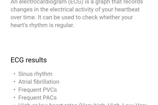 OnePlus Watch 3 - ECG
