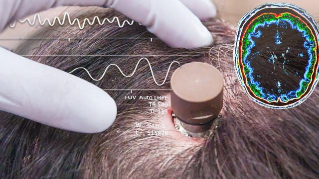 <b>Elon Musk începe testele pe oameni cu Neuralink în 2023: cipuri instalate în creiere umane</b>Pe lângă Twitter, Tesla şi SpaceX, Elon Musk mai patronează o firmă/proiect numit Neuralink. E poate mai important decât celelalte, deoarece dă speranţa celor paralizaţi de a-şi recapăta abilităţile motorii. După multiple teste pe maimuţe în 2023