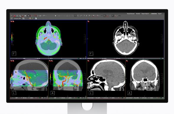 Apple Studio Display (2026) - Fotografii oficiale: Apple-Studio-Display-XDR-Visage-7-260303.jpg